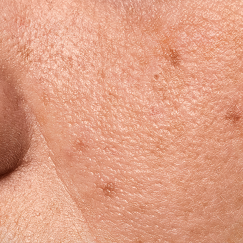 Skin concern pigmentation